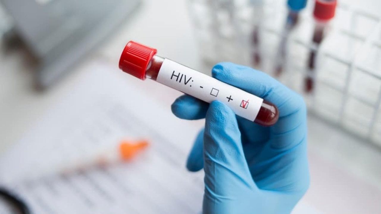 HIV Virüsü ve Bulaşma Yolları Araştırması