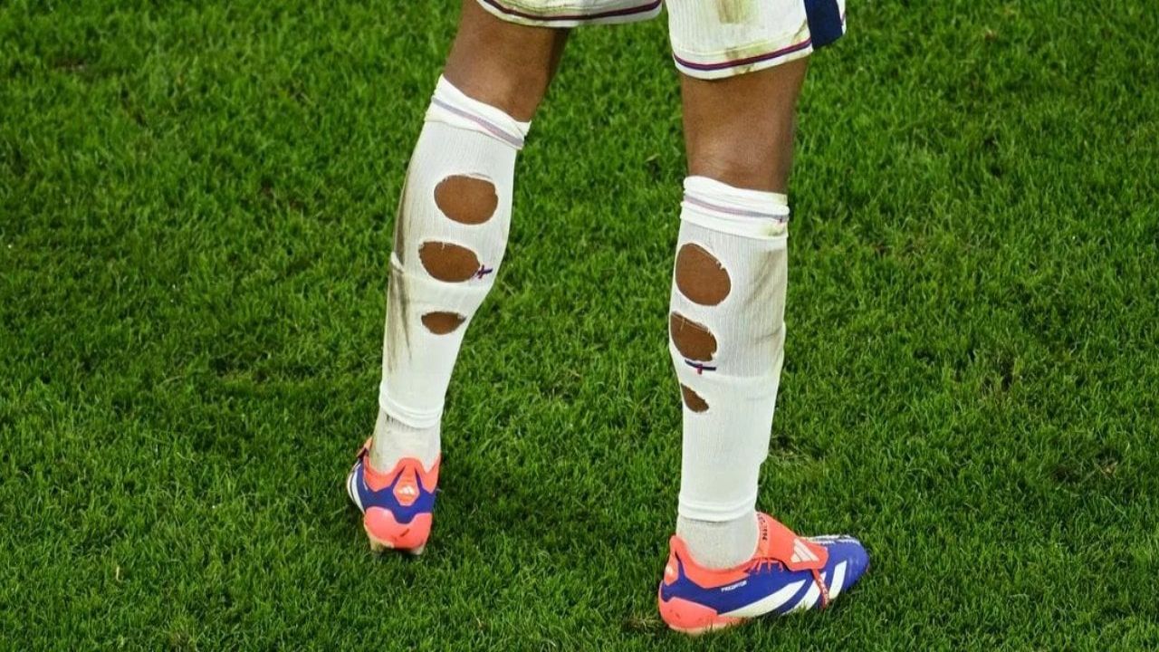 İngiliz Futbolcuların Delik Çorap Giyme Nedeni Açıklandı