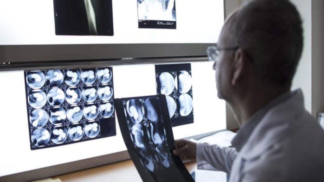 Ciğerlerinde bulunan sürpriz nesne doktorları şaşırttı