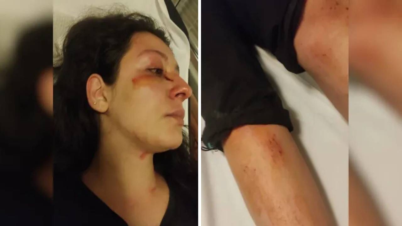 Hayvansever anne ve kızına sokak hayvanlarına yemek verirken komşu saldırısı