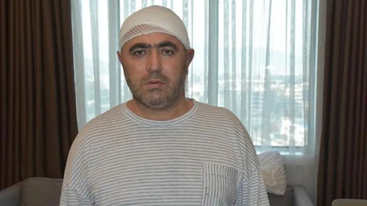 Adamın 13 Dişi Birden Çekildi: Acı Dolu Bir Hikaye