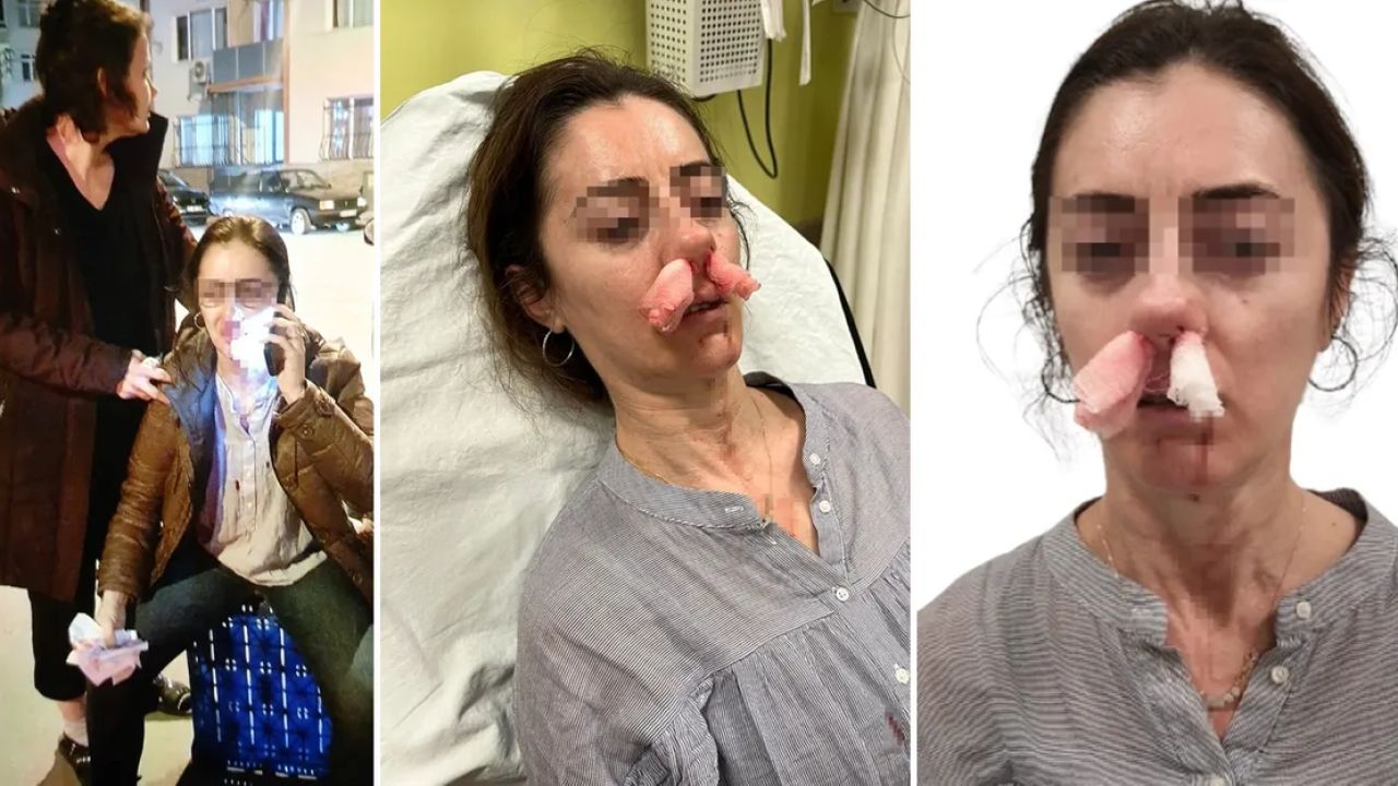 Kadını yanlış tanıyınca saldırdı ve kaçtı