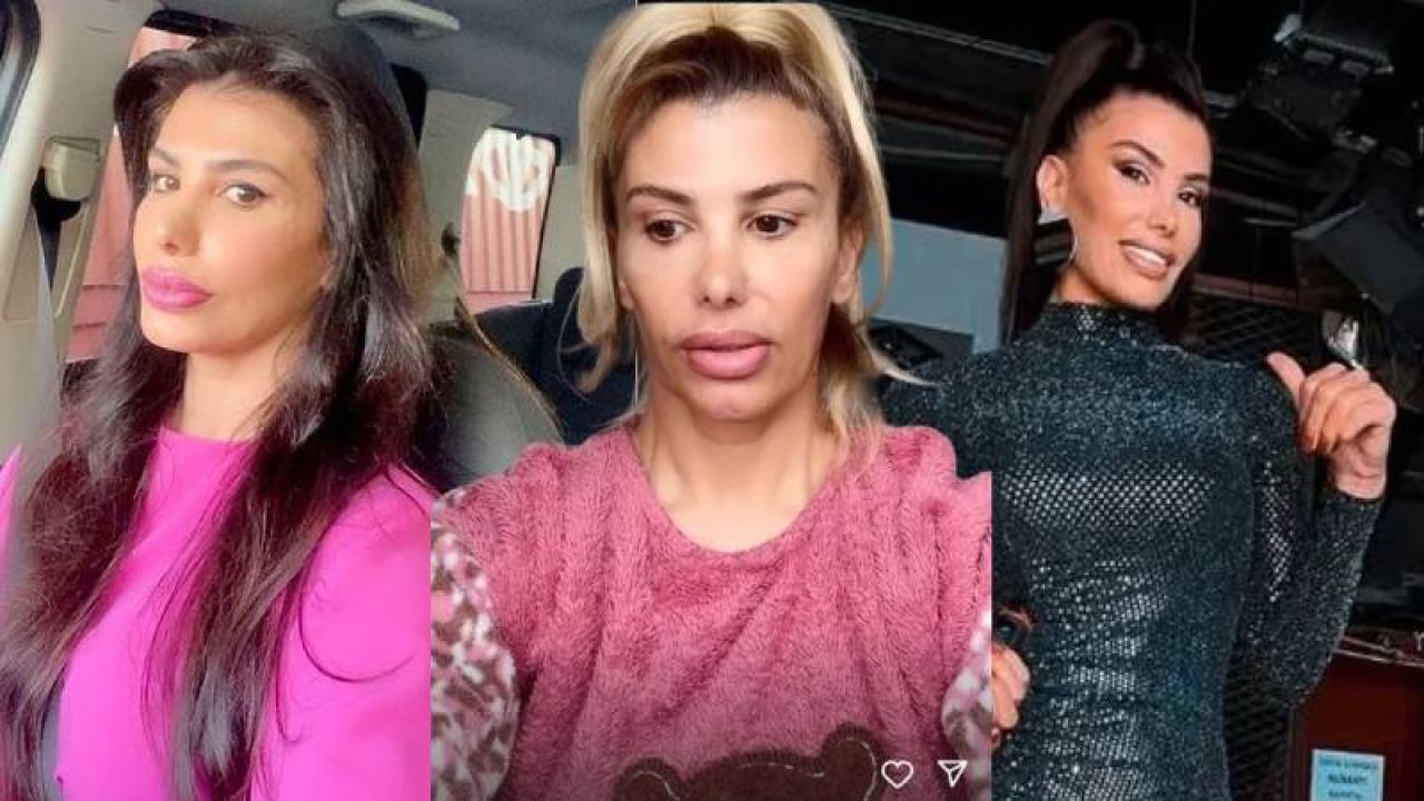 Hatice, botoks zehirlenmesi sonrası sağlık durumunu paylaştı