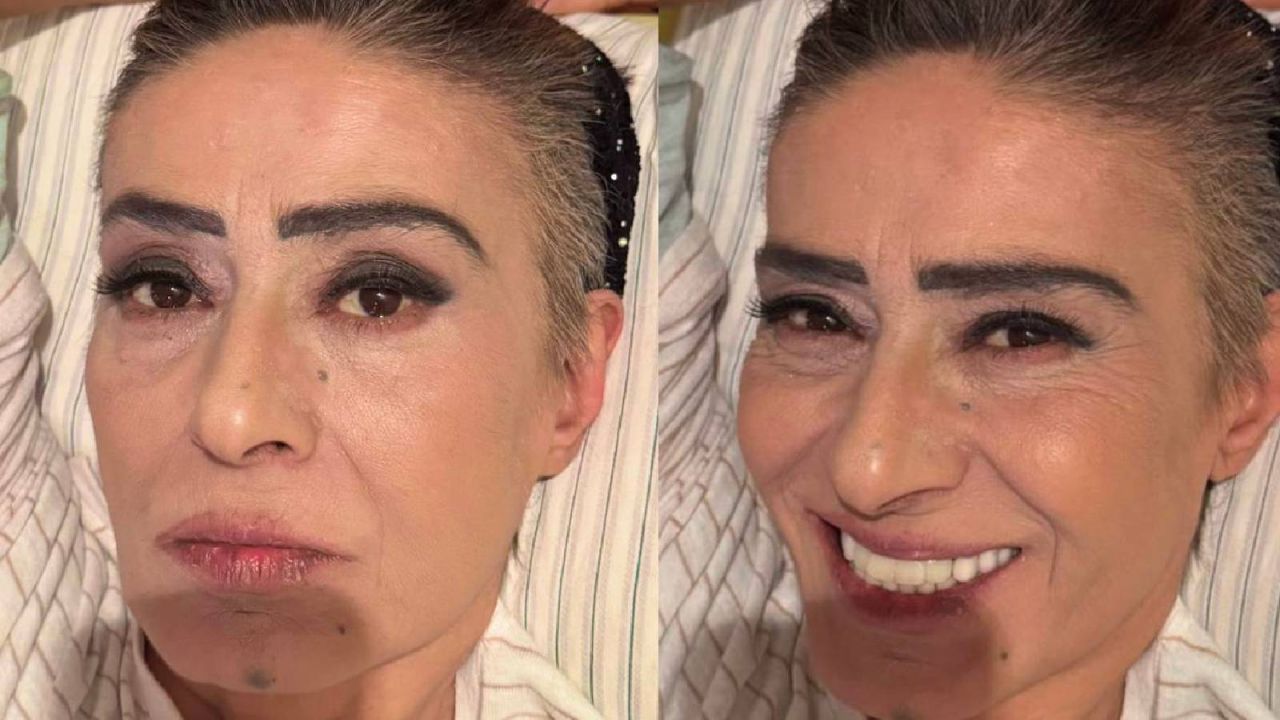 Yıldız Tilbe: Yaralarım geçmeyecek