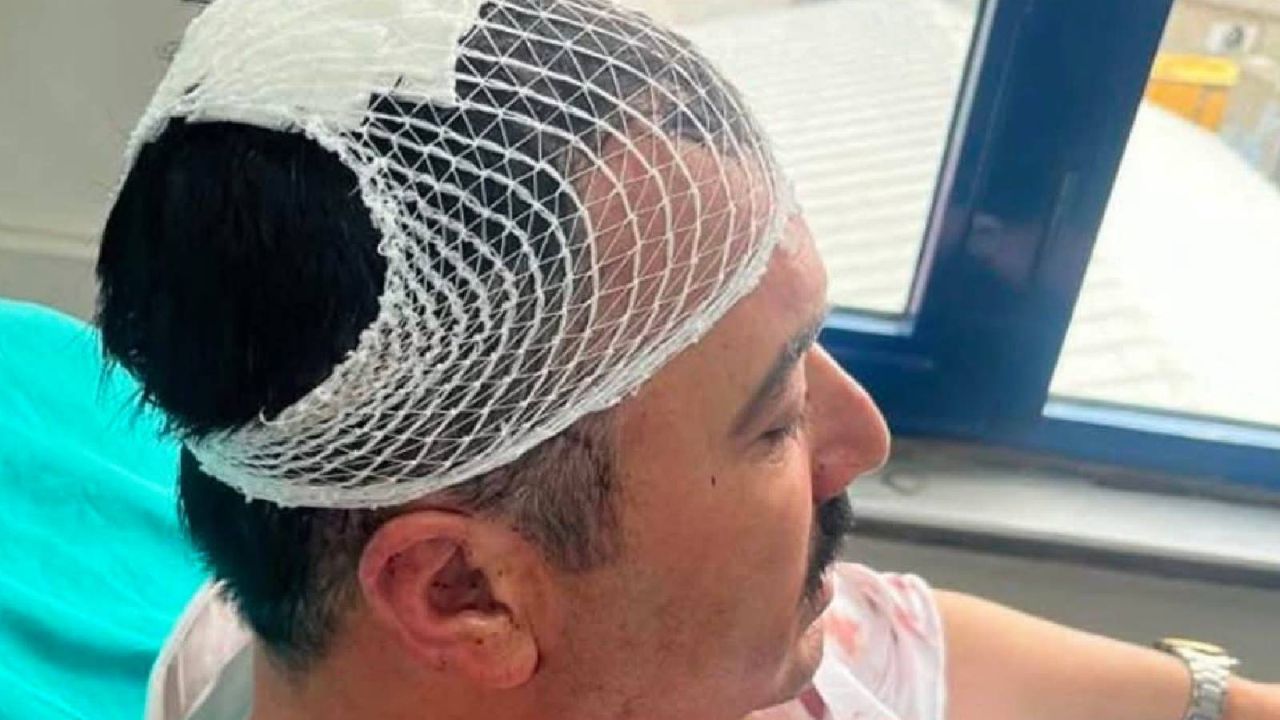 Yrp'li il başkan yardımcısı, belediye başkan yardımcısını şekerlikle yaraladı
