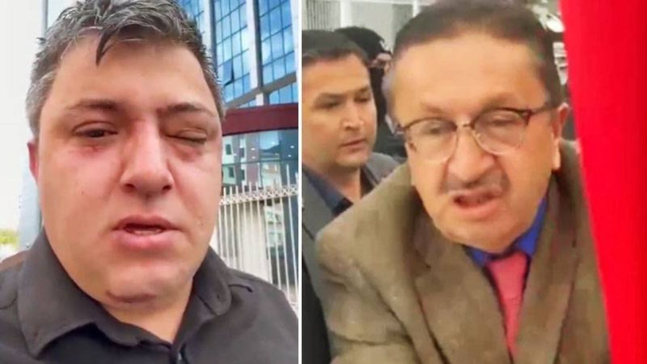 Akp'li Belediye Başkanı Ve Yardımcıları İşçiyi Darbetti İddiası: "Dayak Yedim, Beni Öldürmekle Tehdit Ettiler"

