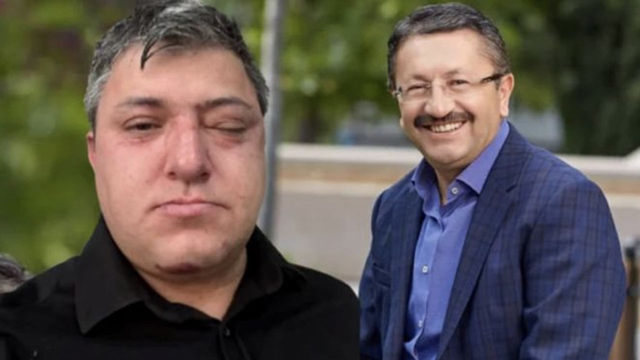 Altındağ Belediyesi'nde Dayak Timi İddiası: Aynı Çalışanlar İki Ayrı Saldırıda
