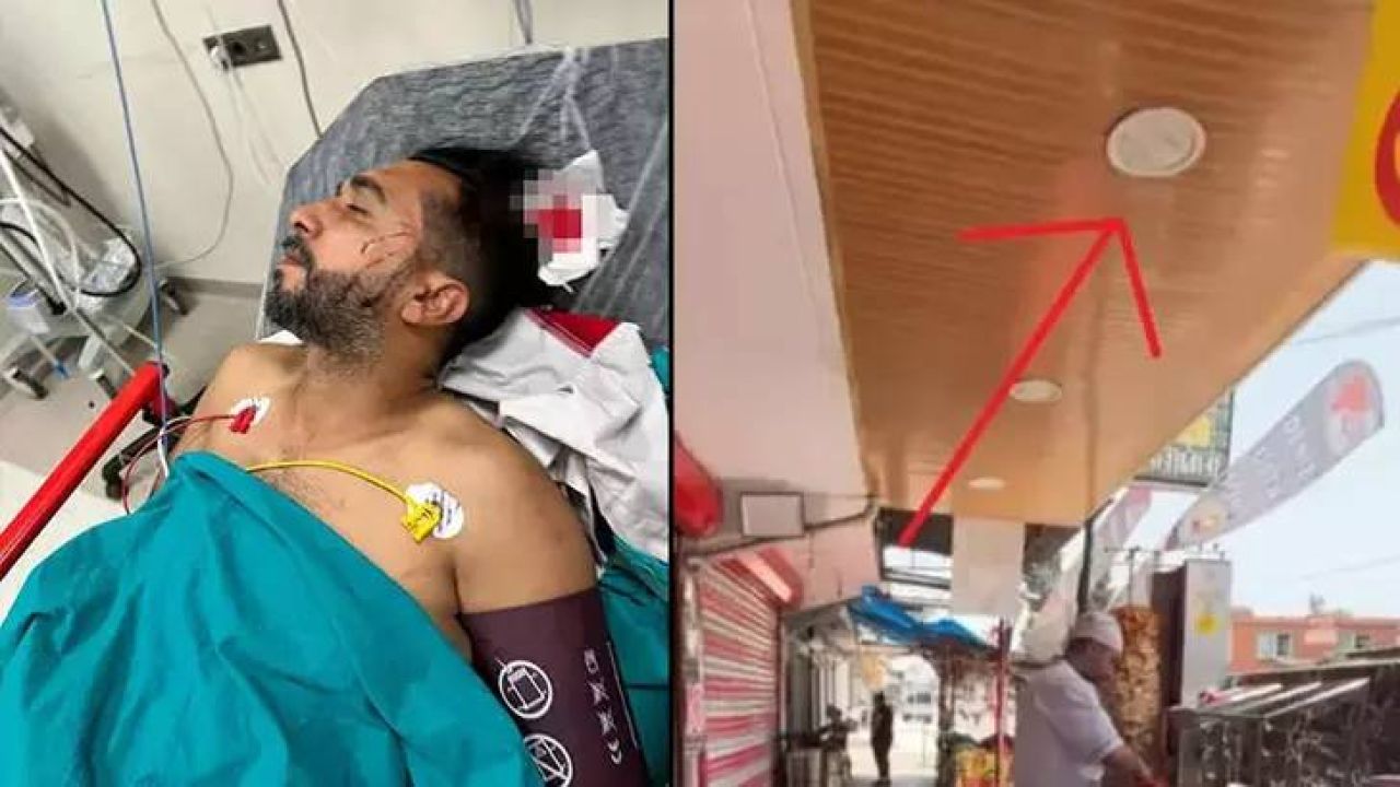 Döner Yerken Başına Kurşun İsabet Etti
