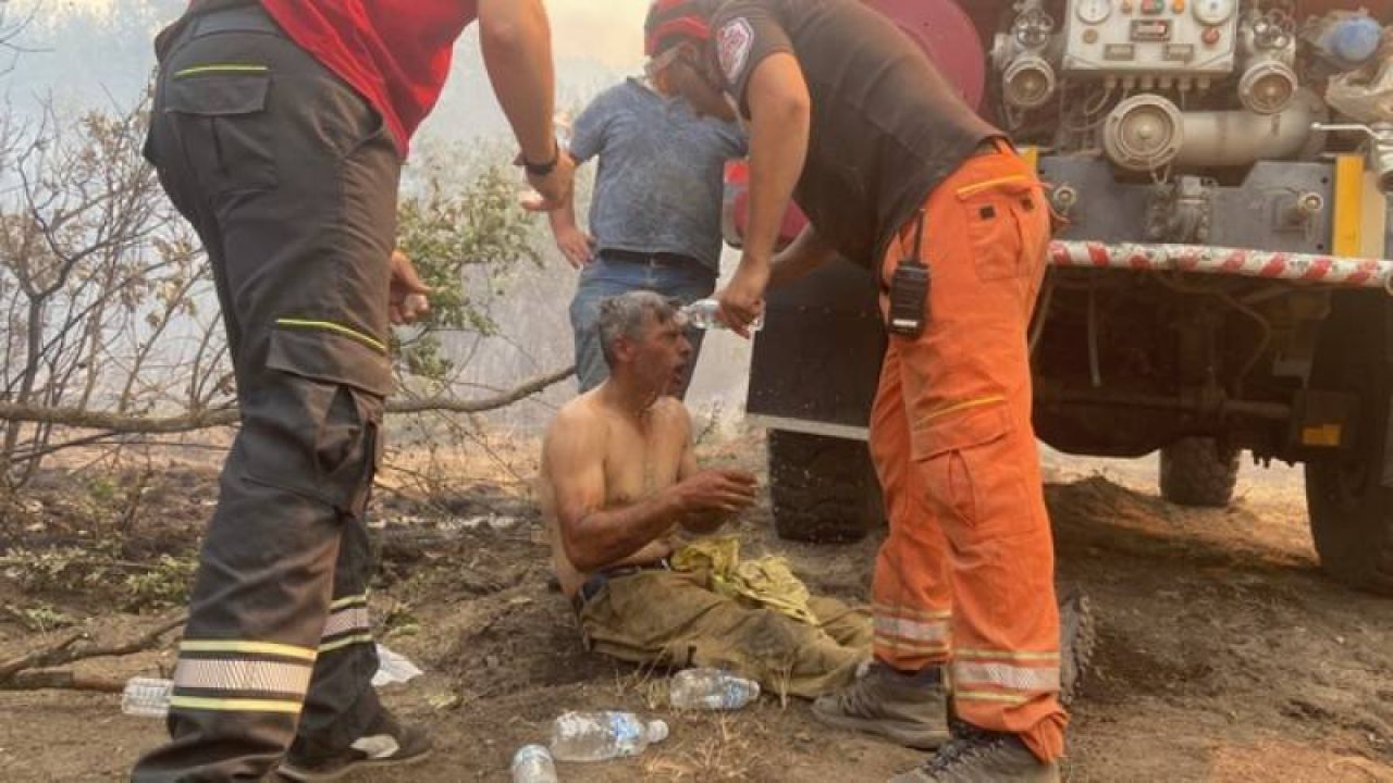 Yangın Faciasından Kurtulan Orman İşçisi Yoğun Bakımda
