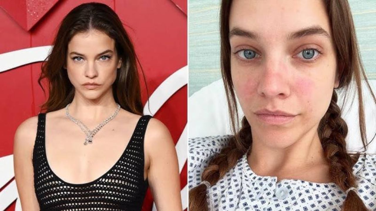 Süper Model Barbara Palvin Gizli Hastalığını Açıkladı: Ameliyat Oldu
