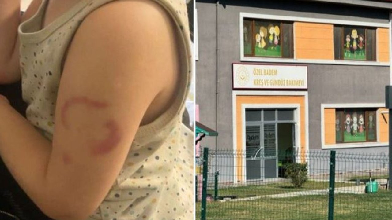Bakımevinde 3 yaşındaki öğrencisinin kolunu ısıran öğretmen tutuklandı